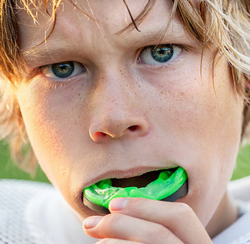 mouthguards